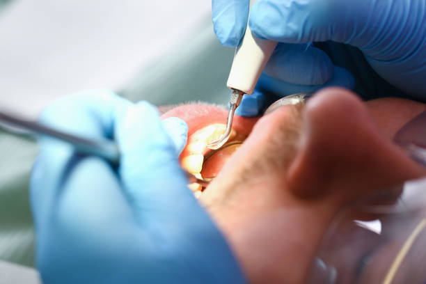Best Urgent Tooth Repair  in Mcdonald, OH