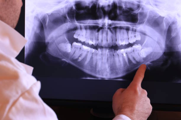 Best Emergency Dental Services Near Me  in Mcdonald, OH