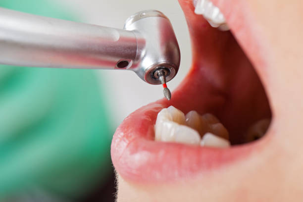 Best Knocked-Out Tooth Emergency  in Mcdonald, OH